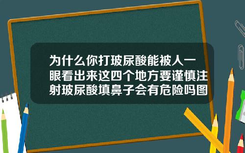为什么你打玻尿酸能被人一眼看出来这四个地方要谨慎注射玻尿酸填鼻子会有危险吗图片
