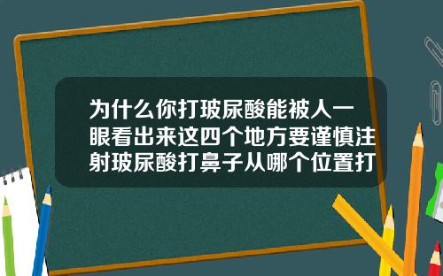 为什么你打玻尿酸能被人一眼看出来这四个地方要谨慎注射玻尿酸打鼻子从哪个位置打