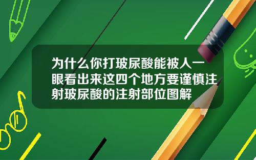 为什么你打玻尿酸能被人一眼看出来这四个地方要谨慎注射玻尿酸的注射部位图解