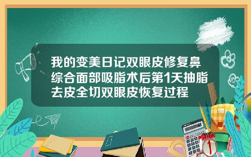 我的变美日记双眼皮修复鼻综合面部吸脂术后第1天抽脂去皮全切双眼皮恢复过程